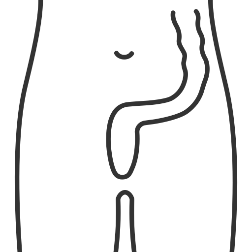 Anal Fistula Surgery Vadodara Dr Samir Contractor