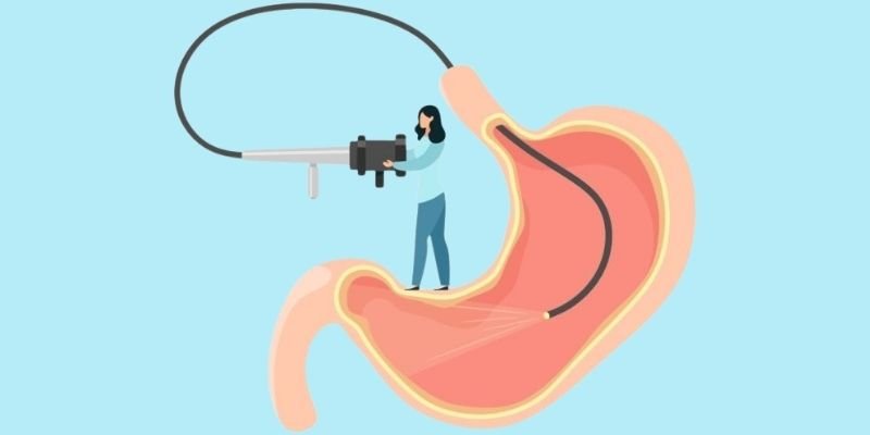 UGI Endoscopy
