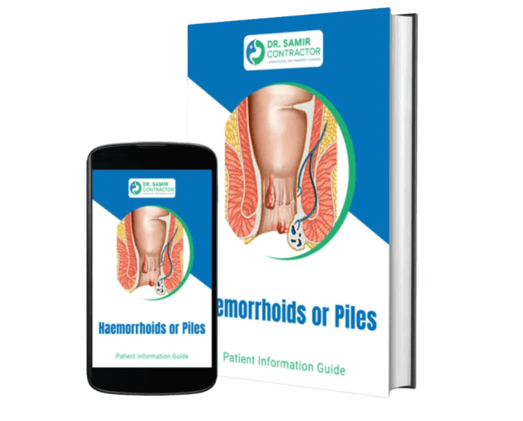 Hemorrhoids / Piles Ebook Mockup