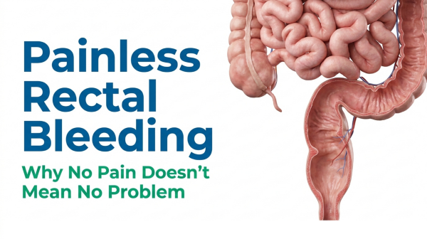 Painless Rectal Bleeding | Causes, Diagnosis, Treatment