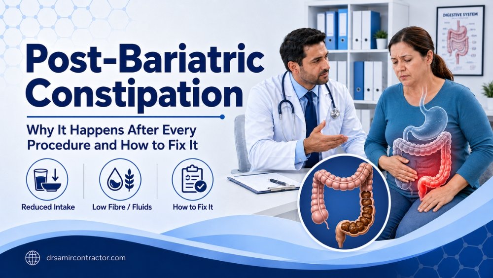 Post-Bariatric Constipation | Causes by Procedure & Treatment