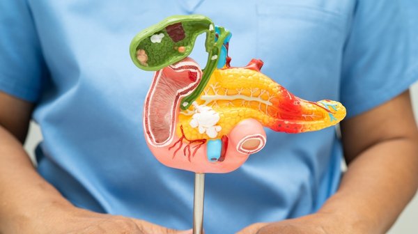 Acute Cholecystitis | Symptoms, Causes & Surgery