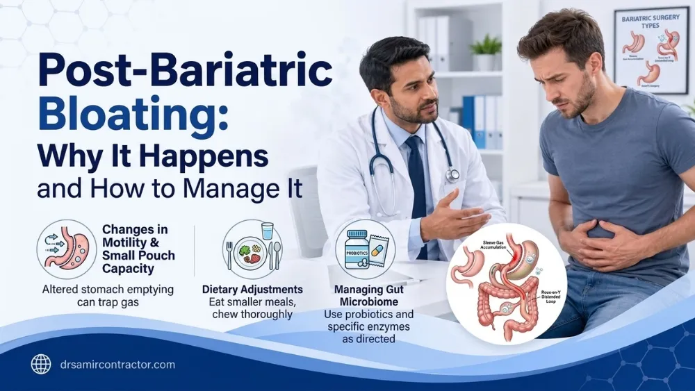 Post-Bariatric Bloating | Causes & Management After Weight Loss Surgery