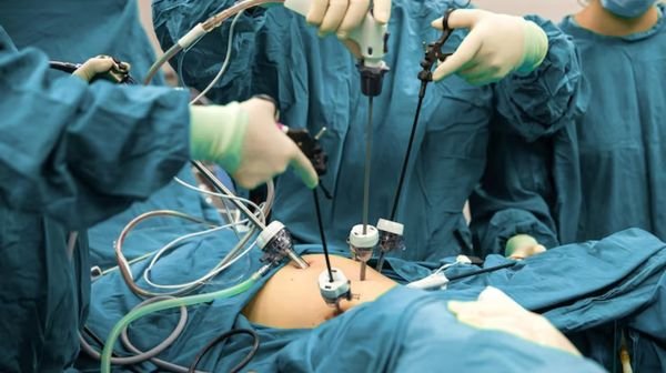 Laparoscopic Hernia Repair: Why Choose This Advanced Treatment Option