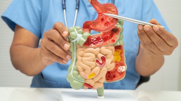 Blood in Stool with Weight Loss | Warning Signs