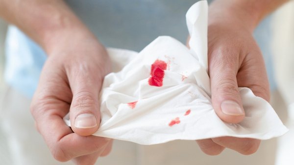 Recurrent Rectal Bleeding | Why It Keeps Coming Back