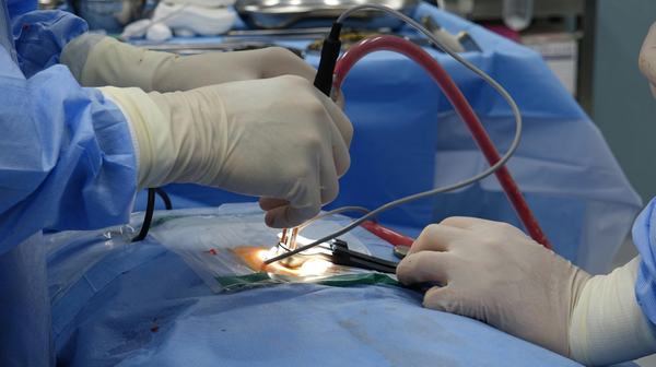 Minimally Invasive Surgery in Vadodara: Safe, Fast‑Recovery Keyhole Surgery