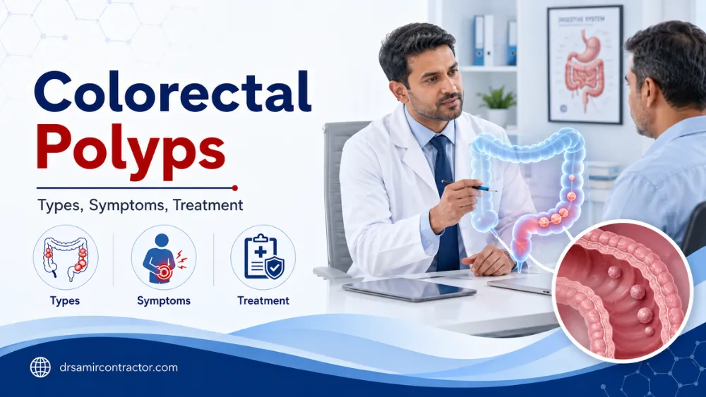Colorectal Polyps | Types, Symptoms, Treatment