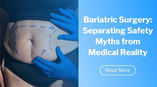 Bariatric Surgery: Separating Safety Myths from Medical Reality